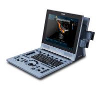 Ультразвуковой сканер Edan U60, аппарат УЗИ цвета, мобильный