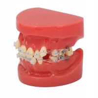 Model demonstracyjny ceramicznego ortodontycznego aparatu QL