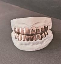 RoseGold Grillz 'y – Basic / połysk
