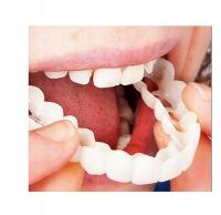 Искусственные зубы временные протезы имплантаты косметические наложение зубов