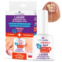 Лак препарат для онихомикоза ног защита Эффектлотос 11мл