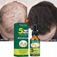 Fast Hair Growth Products 5 Days Ginger Hair Grow