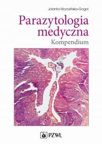 Ebook | Parazytologia medyczna. Kompendium - Jolanta Morozińska-Gogol