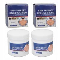 South Moon Psoriasis Treatment Cream Itchy Relief