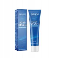 Acne Scar Removal Cream Skin Care Gel Stretch