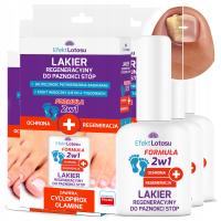 Лак от стригущего лишая для ПАНОККИ ног противогрибковый Эффектlotos 3x 11 мл