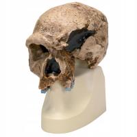 3B Scientific VP753/1 Homo Steinheimensis Skull