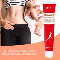 Acne Scar Removal Cream Skin Care Stretch Mar